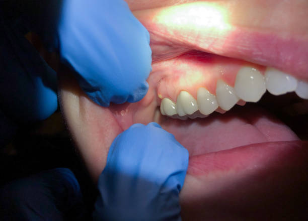 Best Emergency Gum Pain Relief  in Geneva, NY